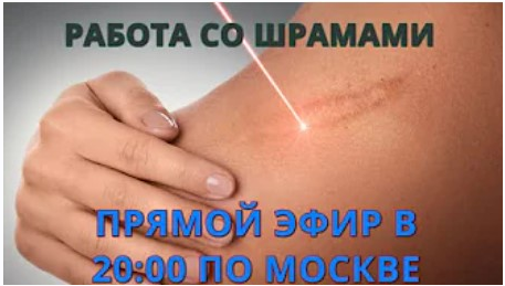 Работа со шрамами (Роман Воронцов).png